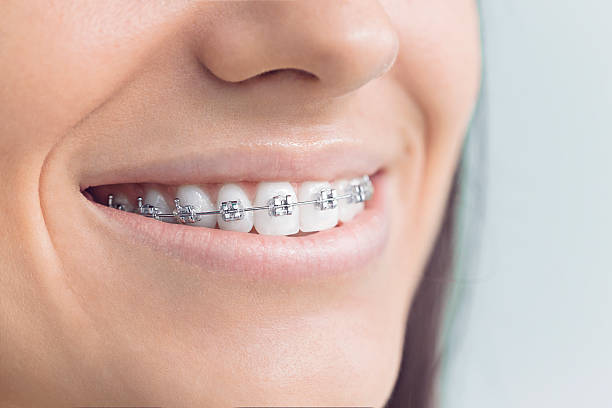 Best Dental Inlays and Onlays  in Lolo, MT
